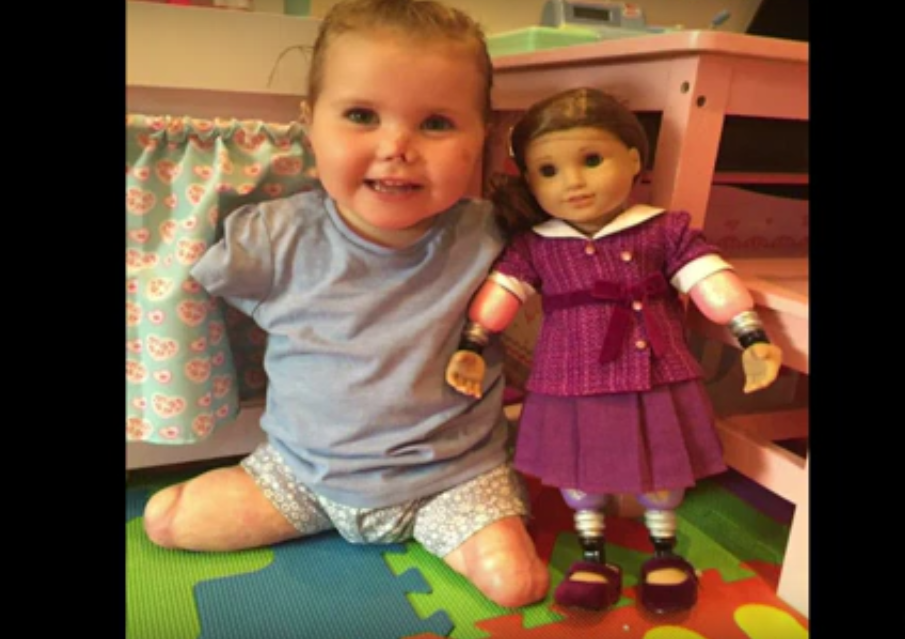 VIDEO: Niña sin extremidades obtiene una muñeca como ella